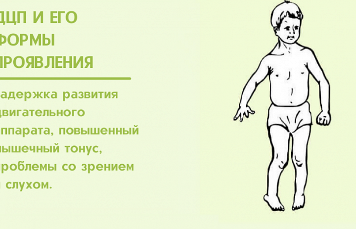 ДЦП и его формы проявления.
